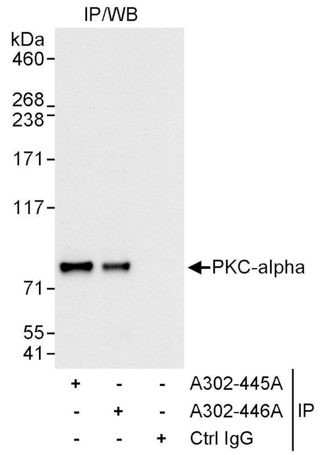 PKC-alpha Antibody in Immunoprecipitation (IP)