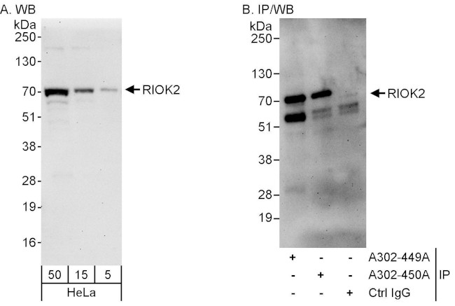 RIOK2 Antibody in Western Blot (WB)