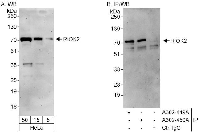 RIOK2 Antibody in Western Blot (WB)