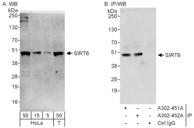 Sirt6 Antibody in Western Blot (WB)