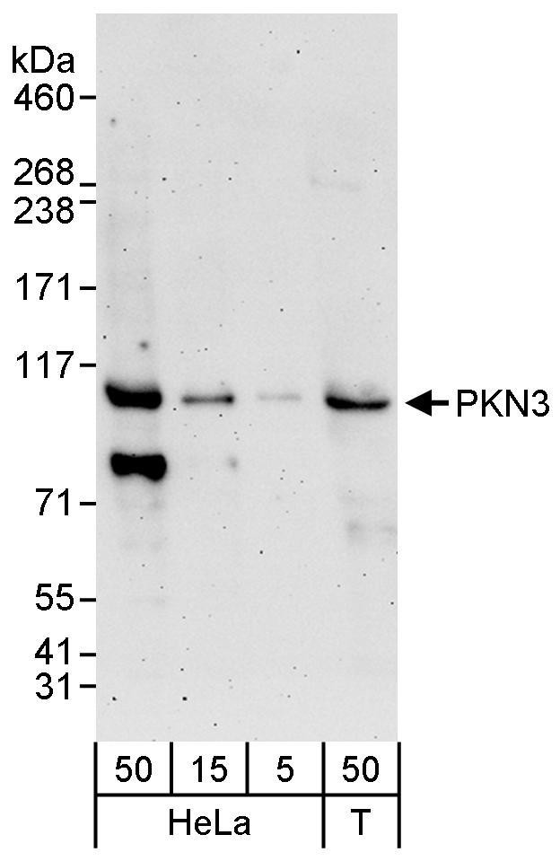 PKN3 Antibody in Western Blot (WB)