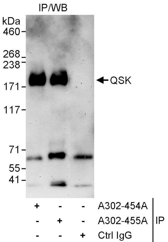 QSK Antibody in Immunoprecipitation (IP)
