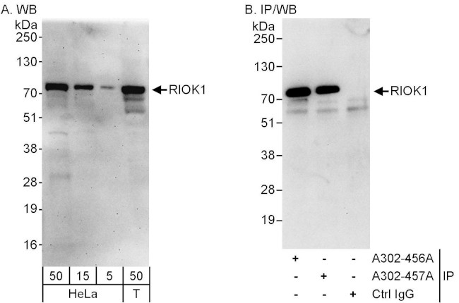 RIOK1 Antibody in Western Blot (WB)