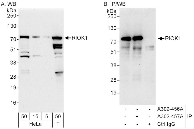 RIOK1 Antibody in Western Blot (WB)