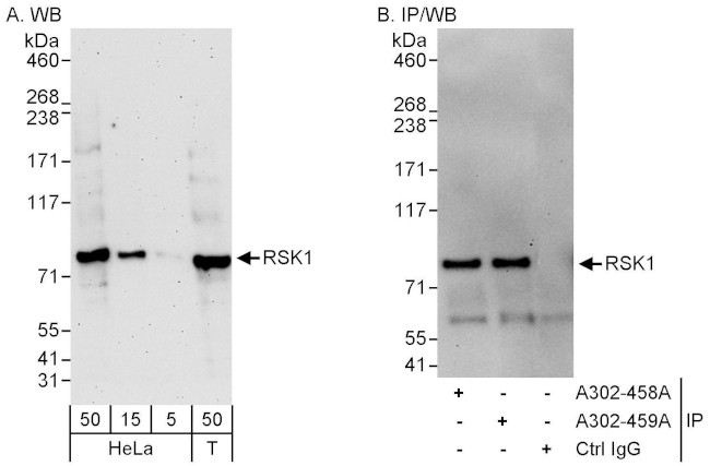 RSK1 Antibody in Western Blot (WB)