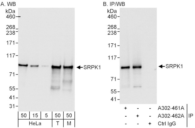 SRPK1 Antibody in Western Blot (WB)