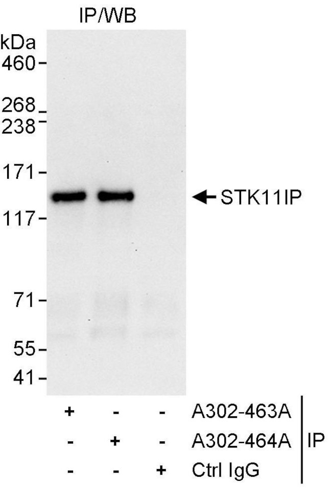 STK11IP Antibody in Immunoprecipitation (IP)