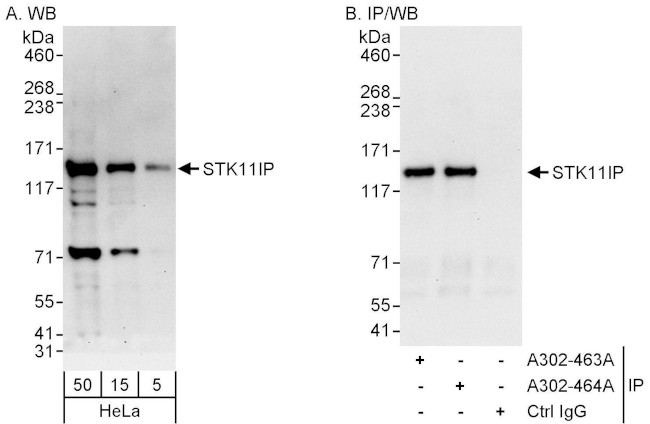 STK11IP Antibody in Western Blot (WB)