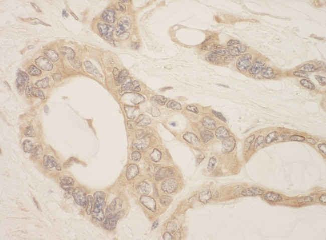 CASC3 Antibody in Immunohistochemistry (Paraffin) (IHC (P))