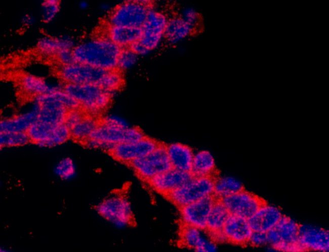 CASC3 Antibody in Immunohistochemistry (Paraffin) (IHC (P))