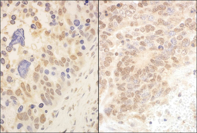 Cul2 Antibody in Immunohistochemistry (Paraffin) (IHC (P))