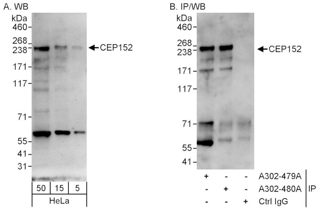 CEP152 Antibody in Western Blot (WB)