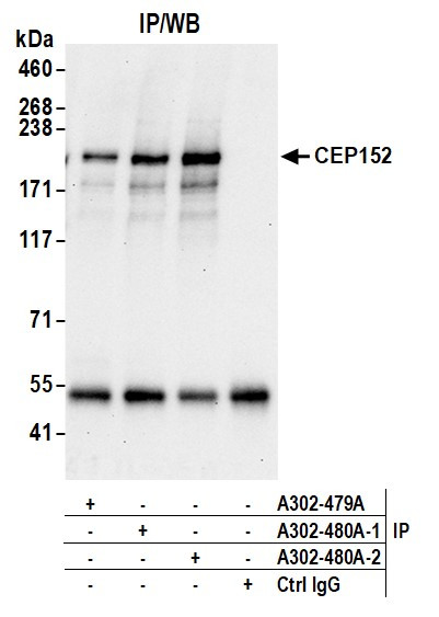 CEP152 Antibody in Immunoprecipitation (IP)