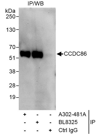 CCDC86 Antibody in Immunoprecipitation (IP)