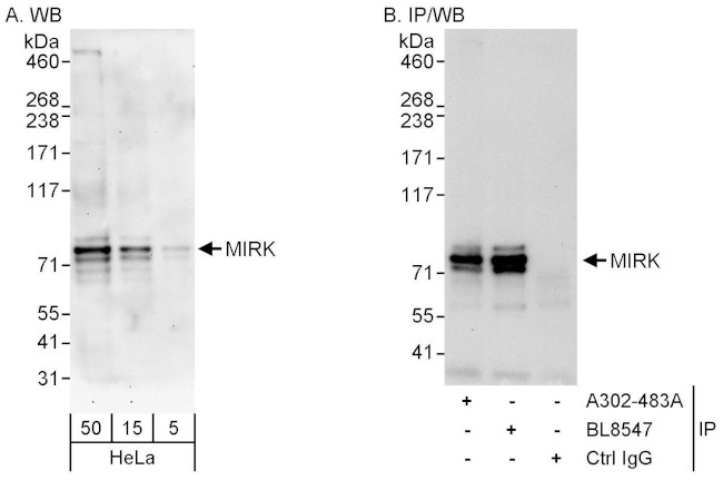 MIRK Antibody in Western Blot (WB)