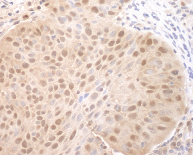 CDC6 Antibody in Immunohistochemistry (Paraffin) (IHC (P))