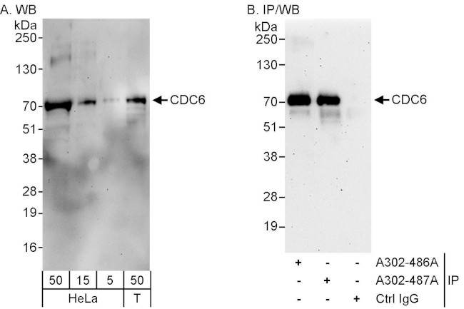 CDC6 Antibody in Western Blot (WB)