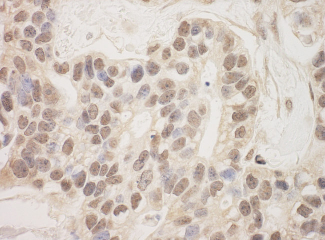 SAP130 Antibody in Immunohistochemistry (Paraffin) (IHC (P))
