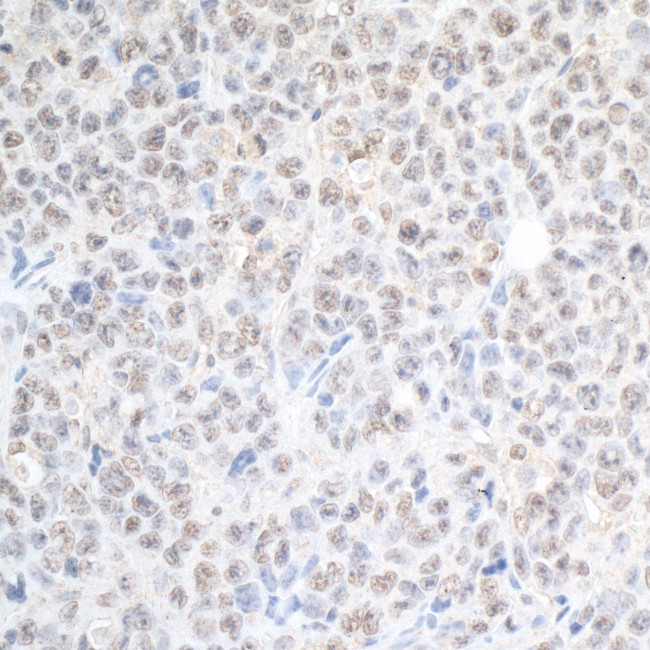 SPF45 Antibody in Immunohistochemistry (Paraffin) (IHC (P))
