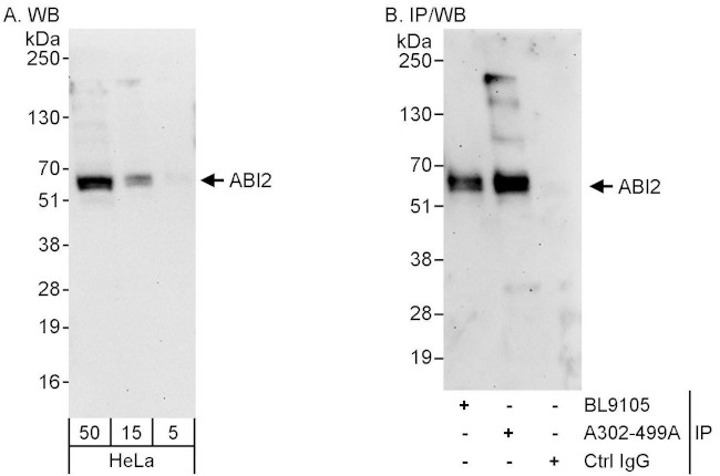 ABI2 Antibody in Western Blot (WB)