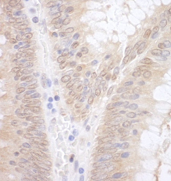 EAF2 Antibody in Immunohistochemistry (Paraffin) (IHC (P))