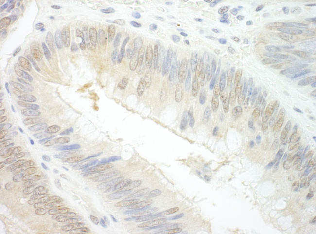EAF2 Antibody in Immunohistochemistry (Paraffin) (IHC (P))