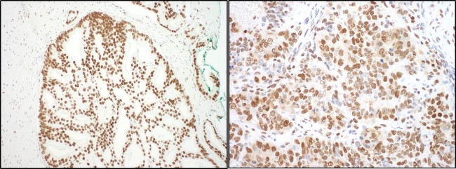 SF3B3 Antibody in Immunohistochemistry (Paraffin) (IHC (P))