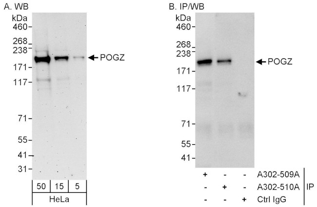 POGZ Antibody in Western Blot (WB)