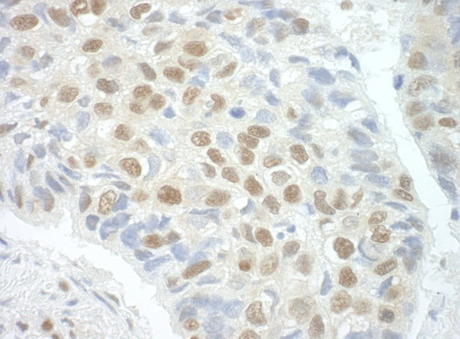 POGZ Antibody in Immunohistochemistry (Paraffin) (IHC (P))
