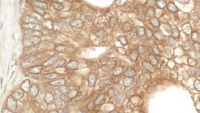 NEDD4L Antibody in Immunohistochemistry (Paraffin) (IHC (P))