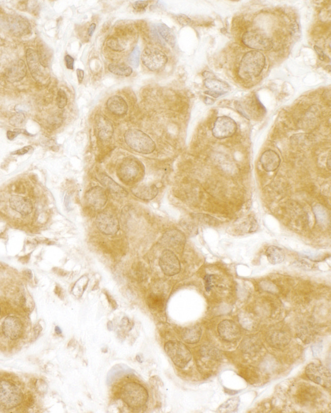 MERIT40 Antibody in Immunohistochemistry (Paraffin) (IHC (P))
