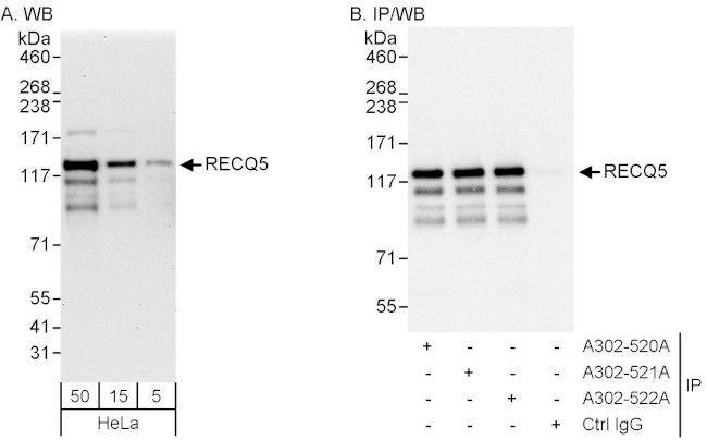 RECQ5 Antibody in Western Blot (WB)