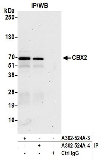 CBX2 Antibody in Immunoprecipitation (IP)