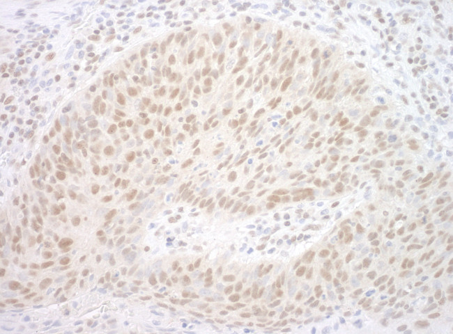 CBX7 Antibody in Immunohistochemistry (Paraffin) (IHC (P))