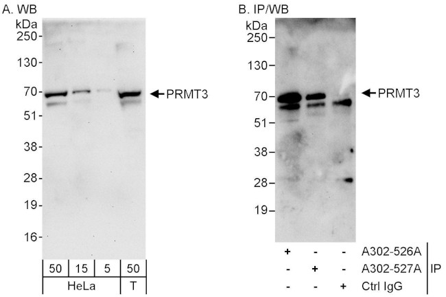 PRMT3 Antibody in Western Blot (WB)
