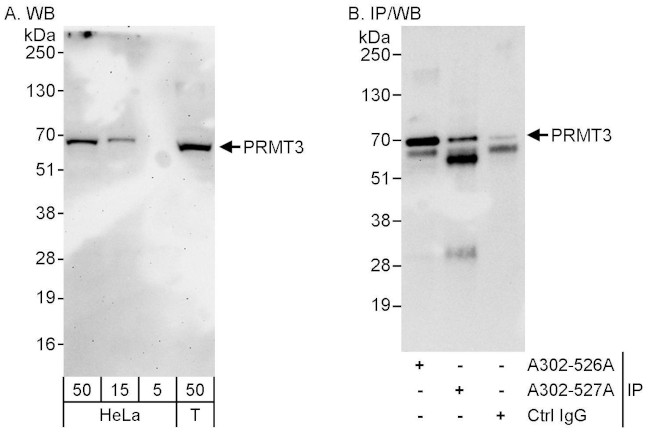 PRMT3 Antibody in Western Blot (WB)
