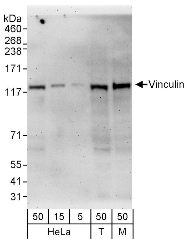 Vinculin Antibody in Western Blot (WB)