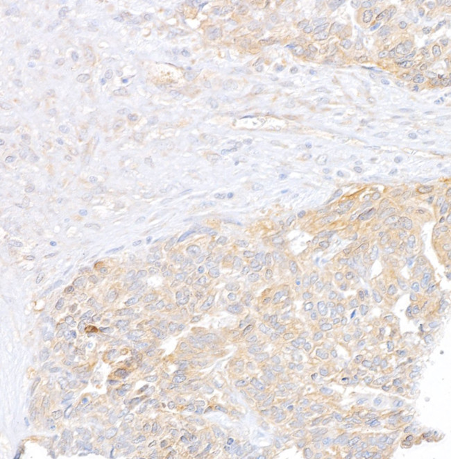 Vinculin Antibody in Immunohistochemistry (Paraffin) (IHC (P))