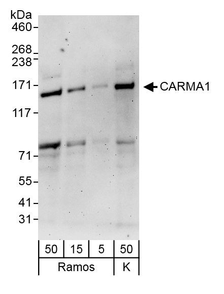 CARMA1 Antibody in Western Blot (WB)