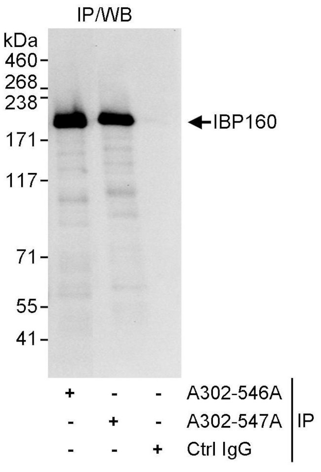 IBP160 Antibody in Immunoprecipitation (IP)