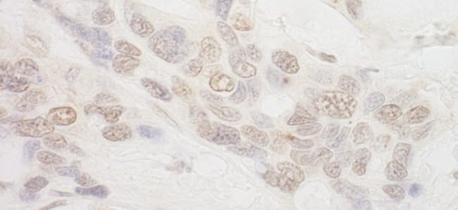 IBP160 Antibody in Immunohistochemistry (Paraffin) (IHC (P))