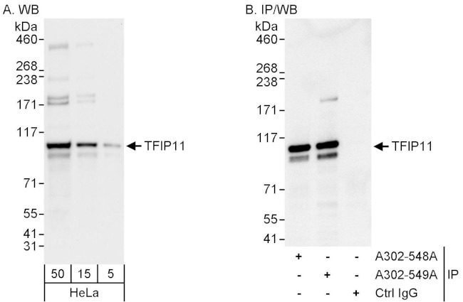 TFIP11 Antibody in Western Blot (WB)