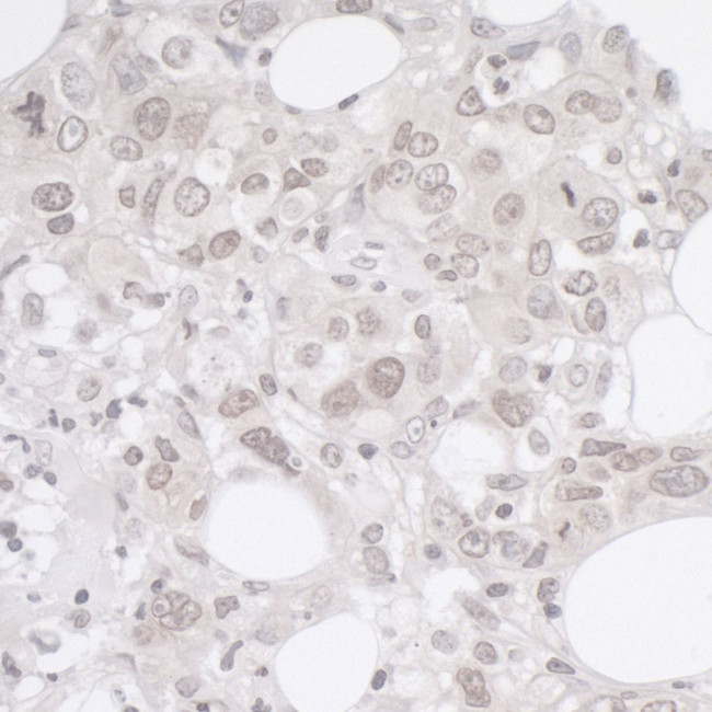ADRM1 Antibody in Immunohistochemistry (Paraffin) (IHC (P))