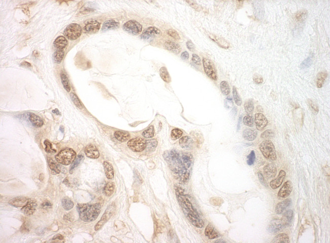 eIF2B5 Antibody in Immunohistochemistry (Paraffin) (IHC (P))