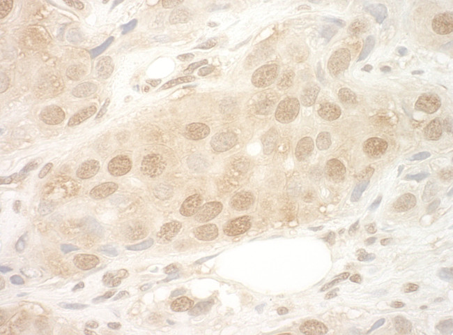 eIF2B5 Antibody in Immunohistochemistry (Paraffin) (IHC (P))