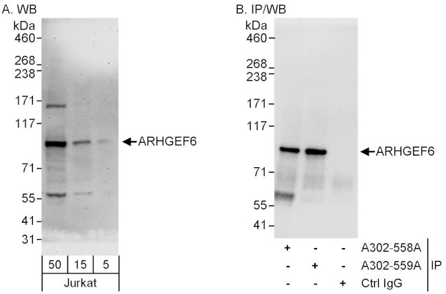 ARHGEF6 Antibody in Western Blot (WB)