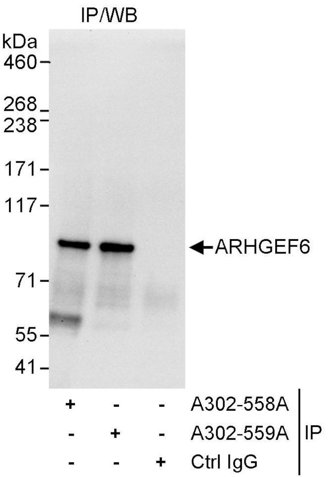 ARHGEF6 Antibody in Immunoprecipitation (IP)