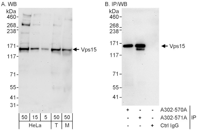 Vps15 Antibody in Western Blot (WB)