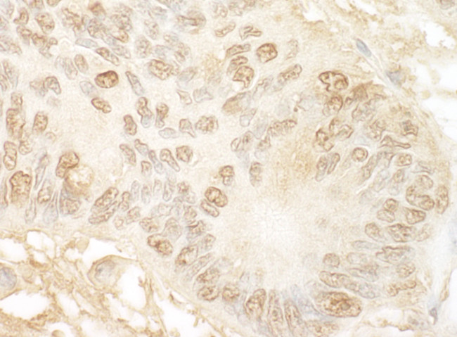 JMY Antibody in Immunohistochemistry (Paraffin) (IHC (P))