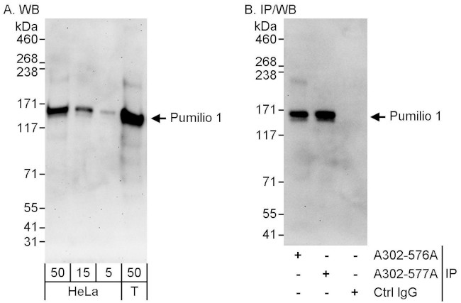Pumilio 1 Antibody in Western Blot (WB)
